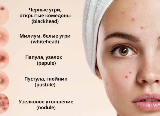 Как лечить акне на подбородке у домашней кошки